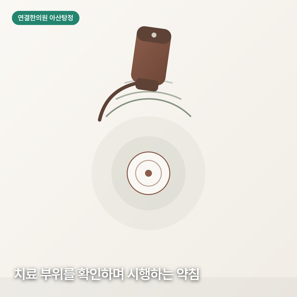 초음파 탐촉자가 치료 부위를 향해 신호를 보내는 모습을 표현한 그래픽