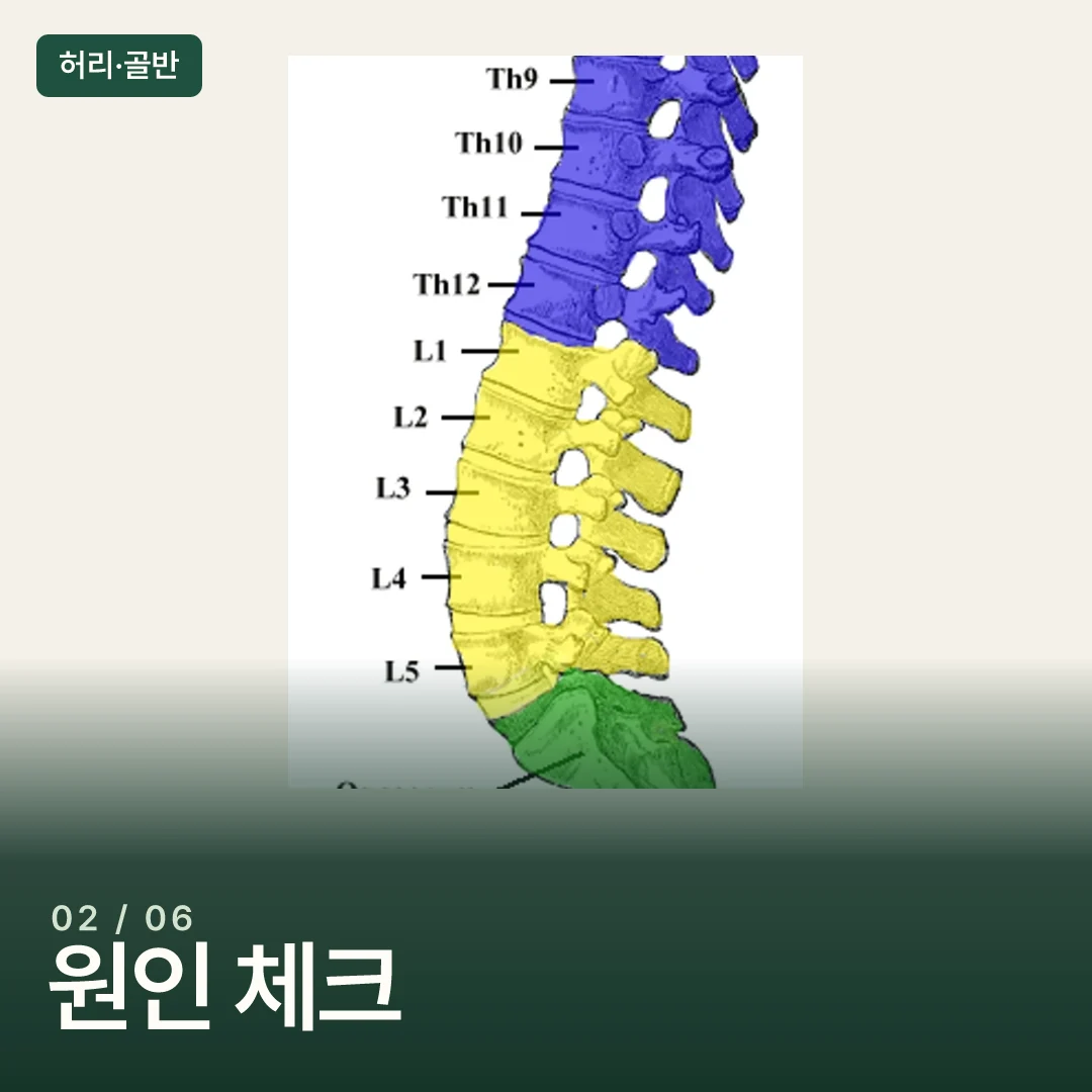 경추·흉추·요추가 이어지는 척추 측면도