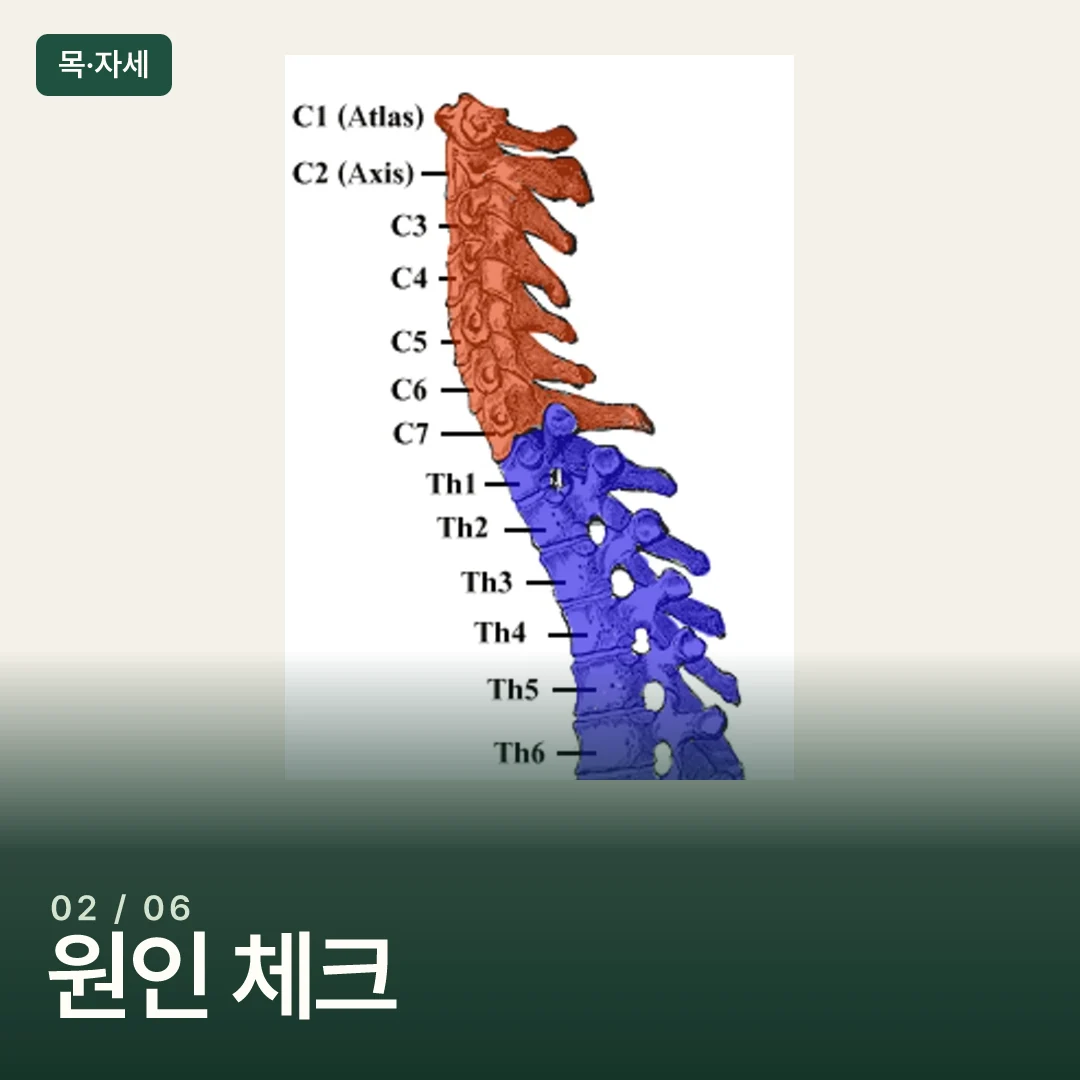 척추 측면에서 본 목뼈와 주변 척추의 위치