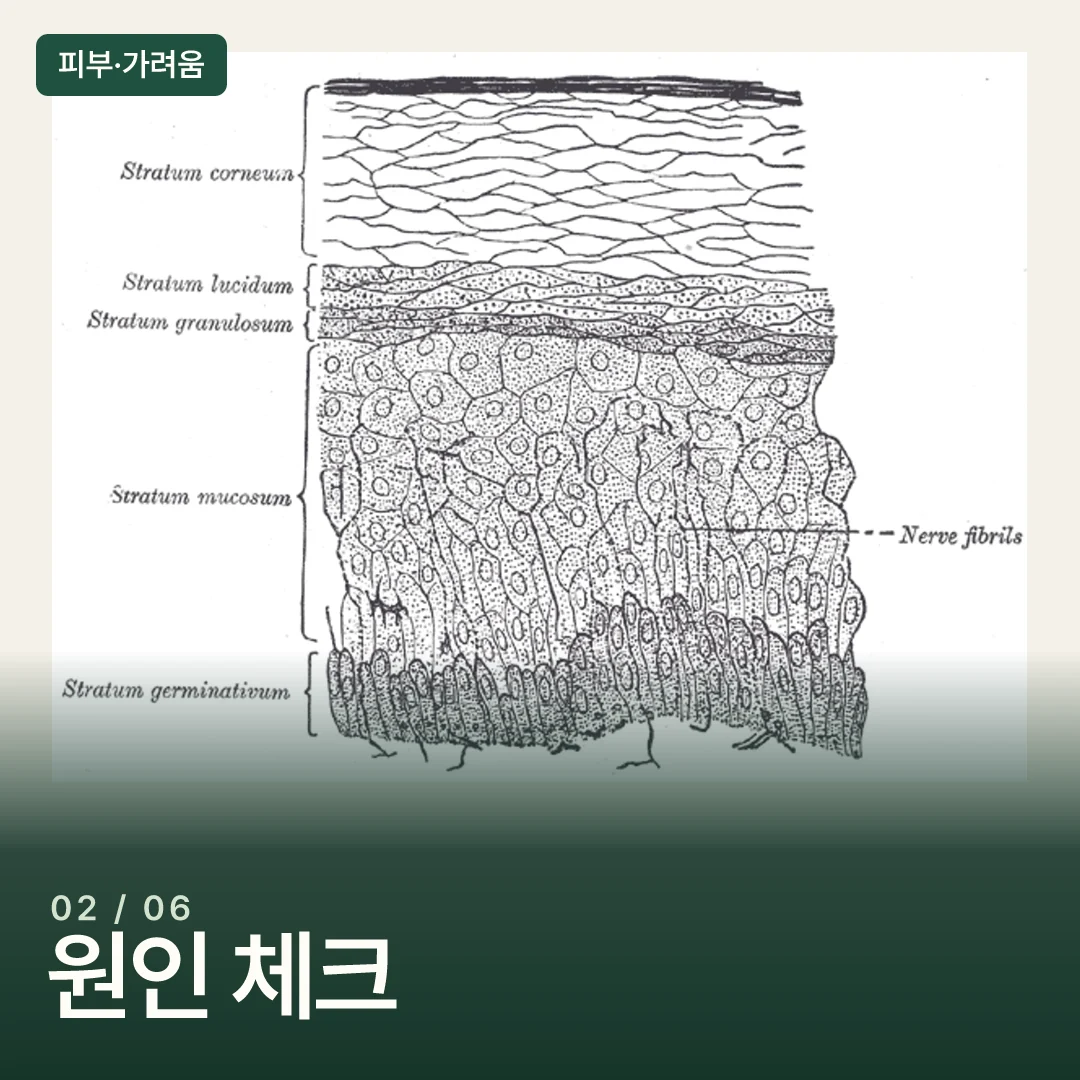 표피·진피 등 피부 단면 구조