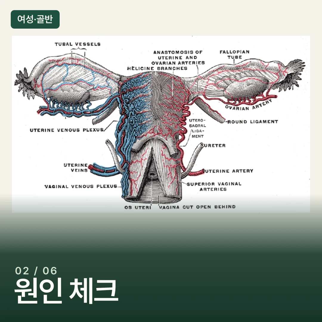 자궁·난소와 주변 혈관의 해부학 도판